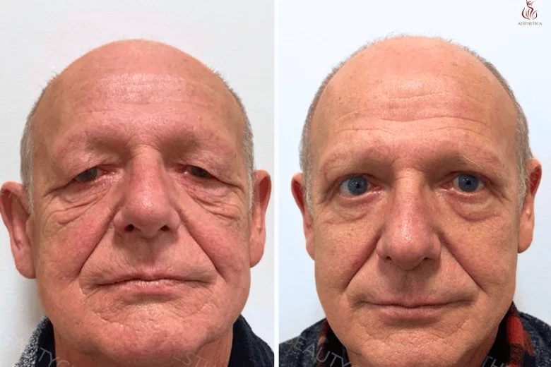 Health Travel - Plastic surgery